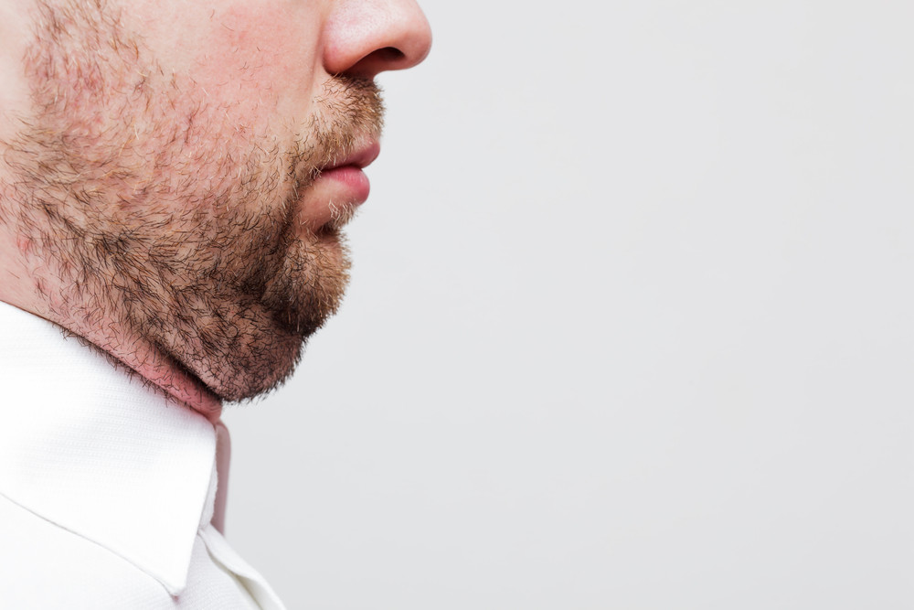 Say Goodbye to Double Chin with Kybella®!