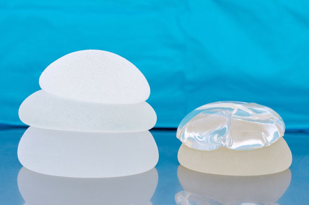 Update on Sientra Implants